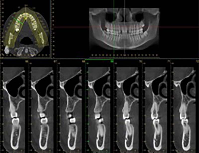 cbct x-ray